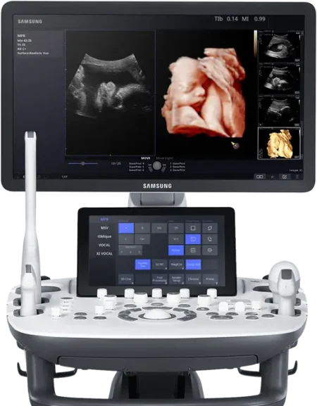 Imagen aumentada del ecógrafo HS50 de Samsung